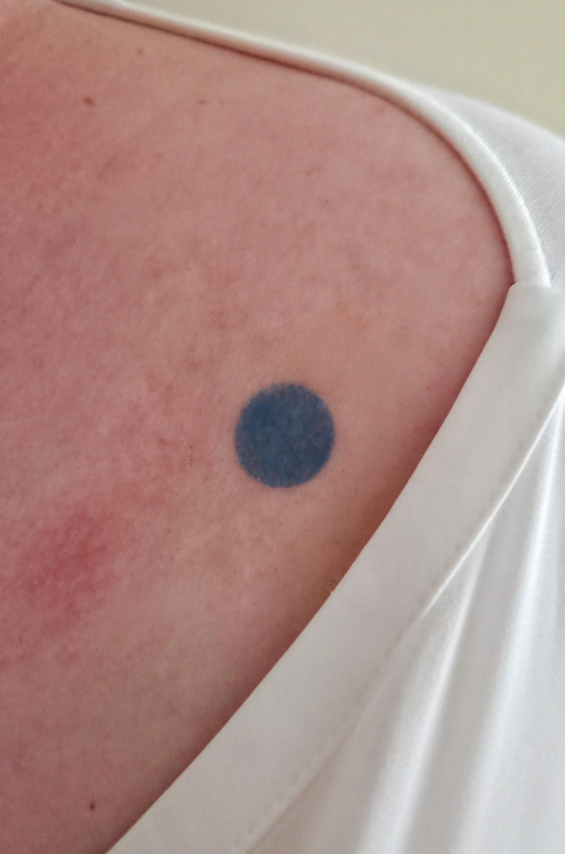 REALIZED: VIA LEWANDOWSKY – BLAUER FLECK 86/100