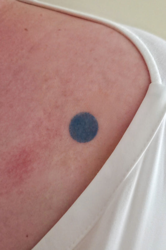 REALIZED: VIA LEWANDOWSKY – BLAUER FLECK 86/100